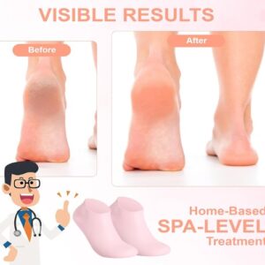 Chaussettes Hydratantes en Silicone – Pour Pieds Secs & Talons Crevassés